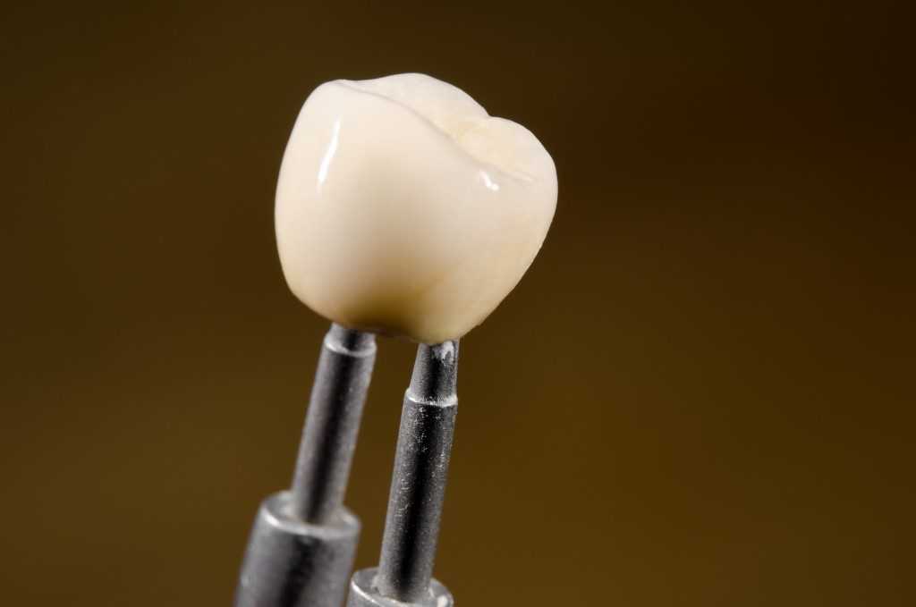 a close look at the structure of dental implant