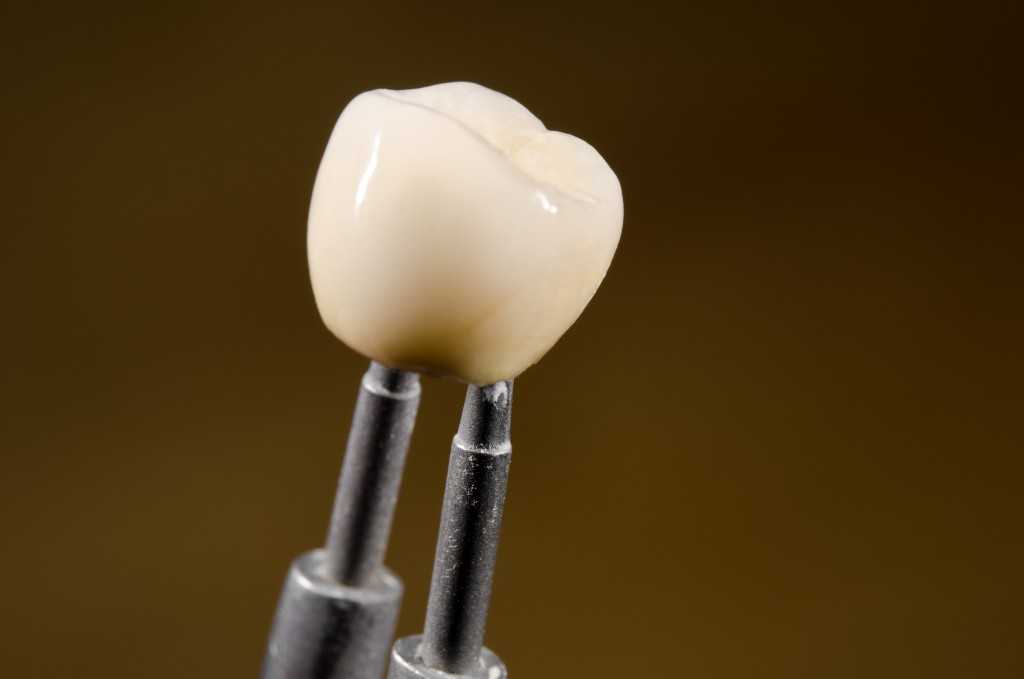 a close look at the structure of dental implant