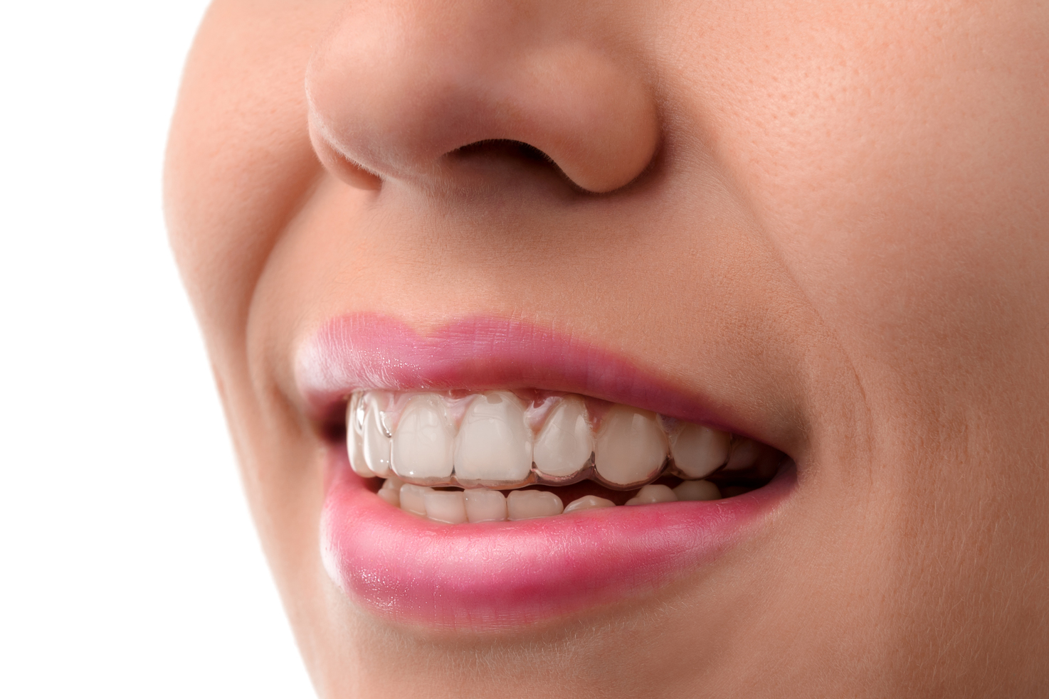 Picture of a woman's white teeth
