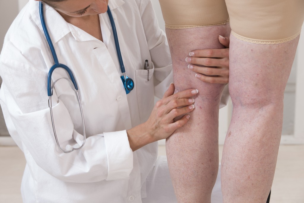 Doctor checking patient's swollen leg