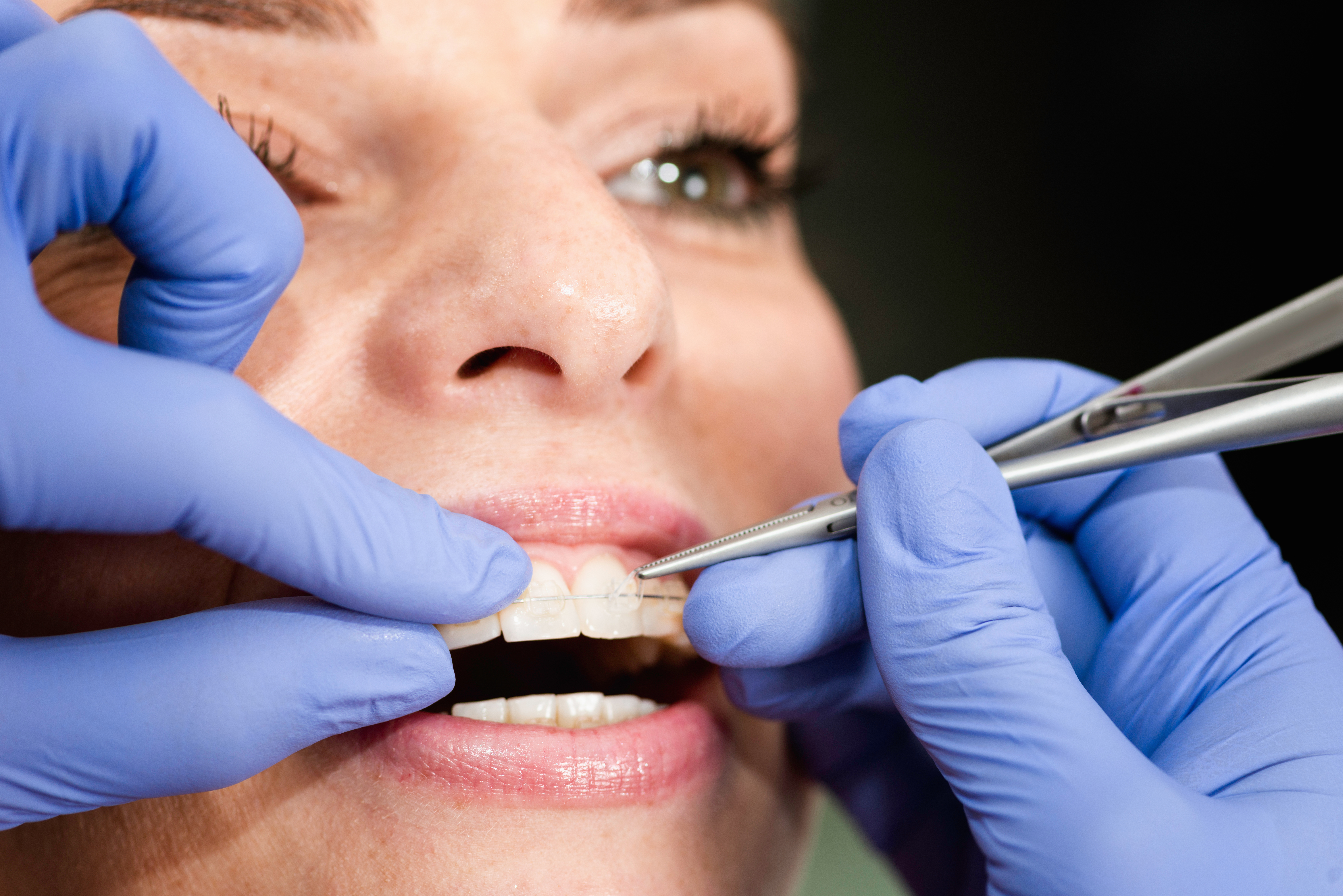 woman having her teeth and braces cleaned