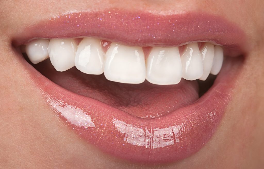 woman's white teeth