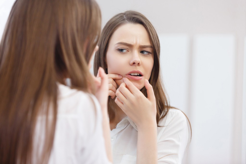 woman with acne