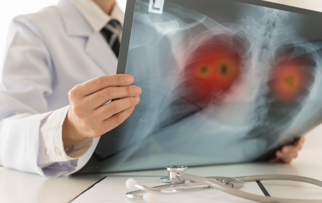 A lung cancer diagnosis