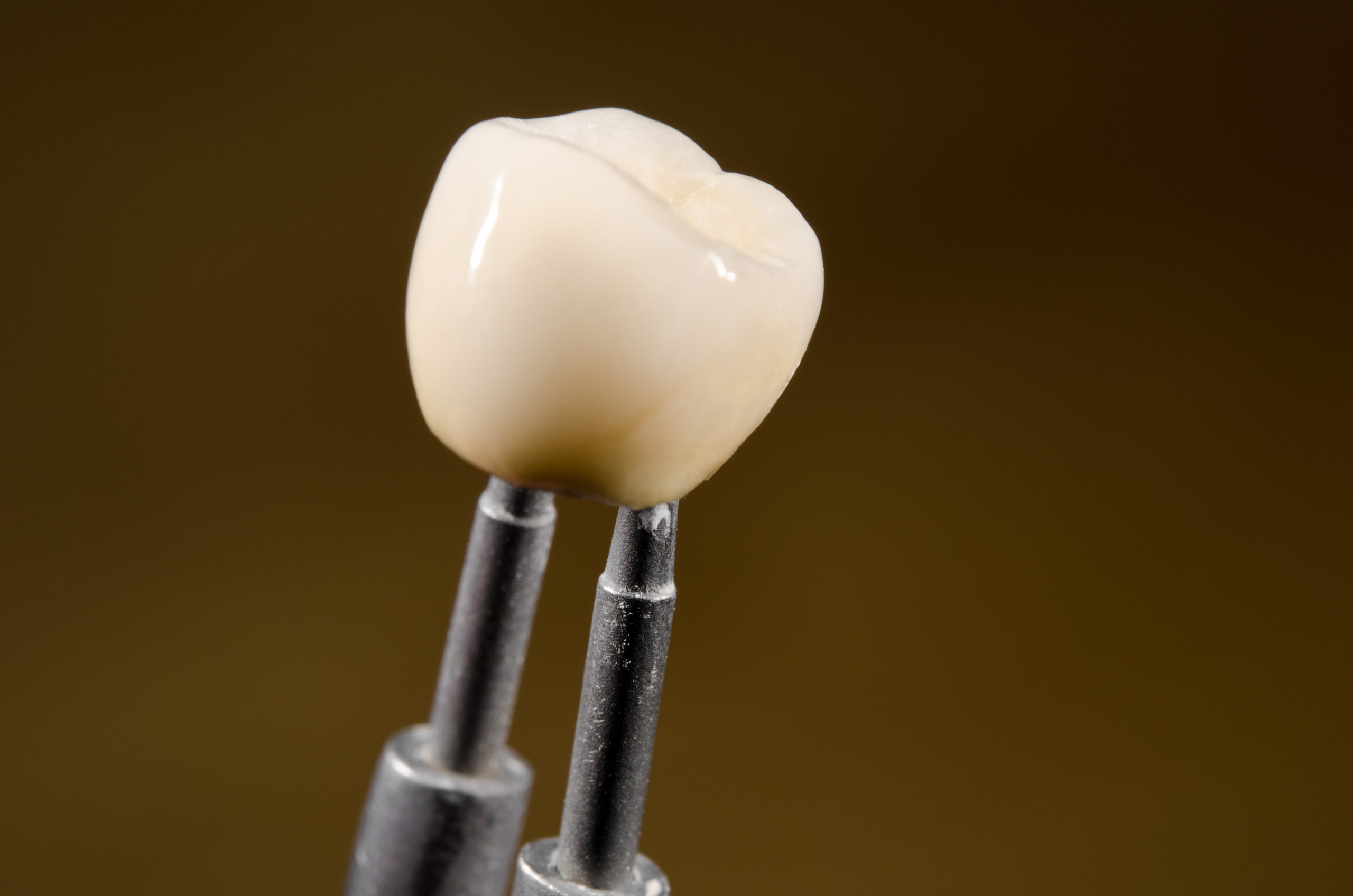 oral implant