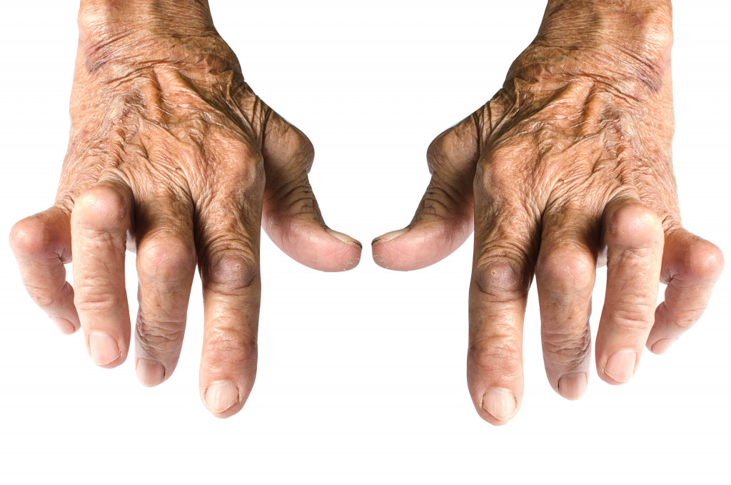 Hand Arthritis