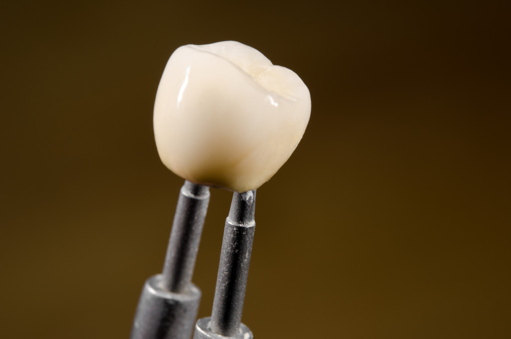 An image of a dental implant