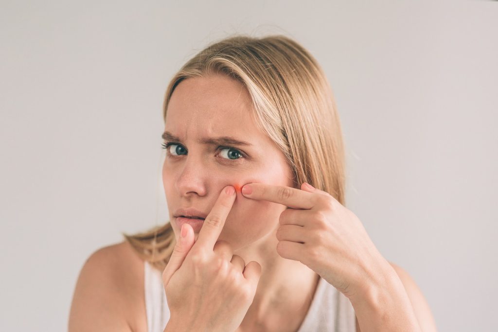 young woman squeezing her pimple